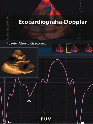 cover image of Ecocardiografía-Doppler